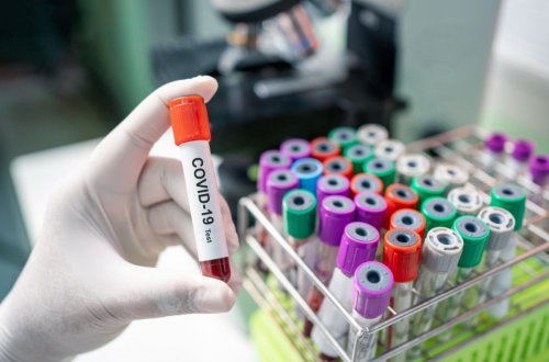 Qazaxıstanda son sutkada COVİD-19-dan 21 nəfər ölüb