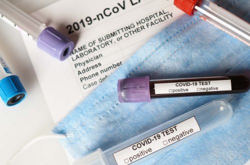 Koronavirusun yeni ştamlarına dair anticisim testi yaradılıb