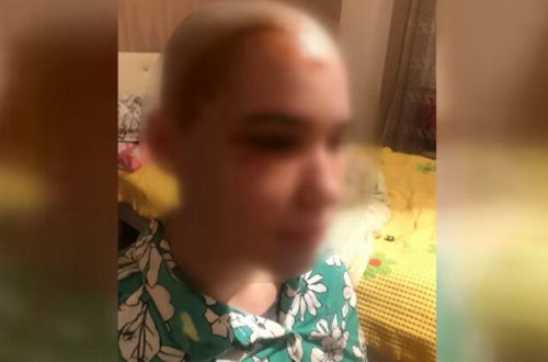 Bakıda gənc qızın başına binadan daş düşdü - VİDEO