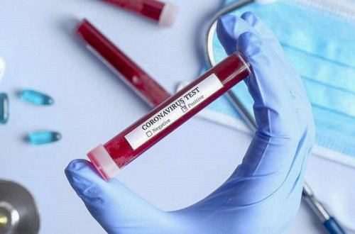 İranda daha 118 nəfər koronavirusdan ölüb