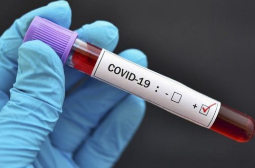 Gürcüstanda daha 3 333 nəfərdə COVID-19 aşkarlanıb, 56 nəfər ölüb