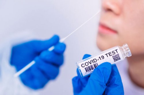 В Азербайджане за последние сутки от коронавируса скончались 23 человека - ФОТО