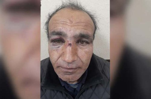 Gürcüstanın hakim partiyasının azərbaycanlı üzvü döyülüb