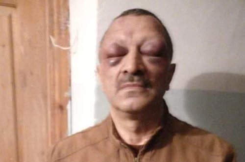 DİN Tofiq Yaqublunun döyülməsi faktını araşdıracaq - FOTO