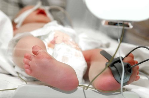 Bakıda koronavirus xəstəsi olan ana süni nəfəs aparatına qoşulu halda uşaq dünyaya gətirdi - FOTO