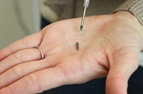 İsveçdə COVID-pasportları çip şəklində vətəndaşlara yeridilməsinə başlanılıb