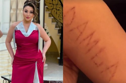 Damla qolunu kəsən fanatı ilə görüşdü