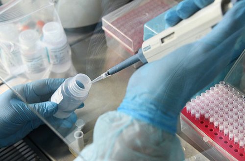 Gürcüstanda “omicron”a yoluxanların sayı artdı