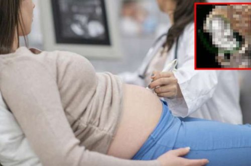 Qorxunc hadisə: Qadını müayinə edən həkim ŞOK YAŞADI - Uzun müddətdir... - FOTOLAR