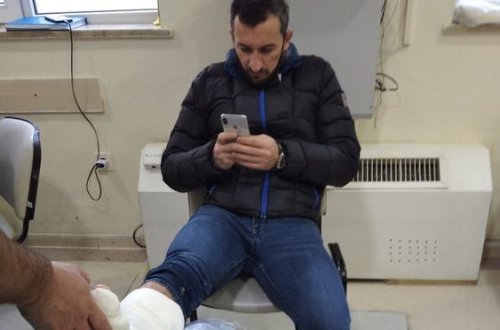 Экс-футболисту сборной Азербайджана наложили гипс на ногу - ФОТО