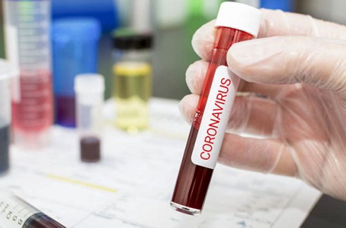 Yoluxanların sayı açıqlandı