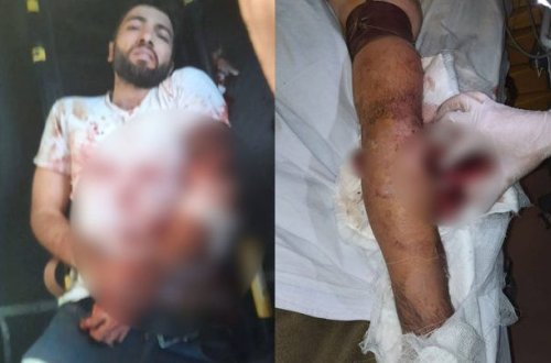 Ermənilərin açdığı atəş nəticəsində “Azercell”in əməkdaşı yaralanıb – FOTO