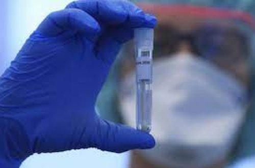 İranda 194 nəfər Omicron ştamına yoluxub