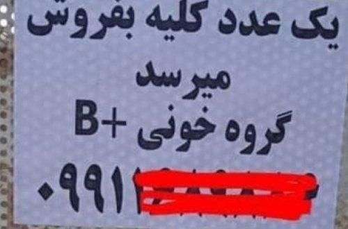 İranda çarəsiz insanlar böyrəklərini satır - FOTO