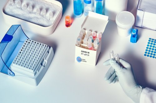 Azərbaycanda daha 547 nəfər koronavirusa yoluxub, 9 nəfər ölüb