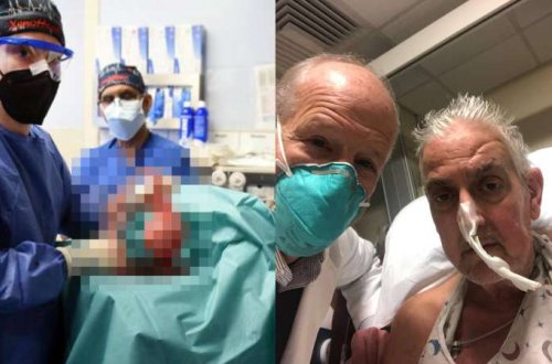 Dünya tibb tarixində İLK YAŞANDI: Donuz ürəyi insana köçürüldü - FOTO