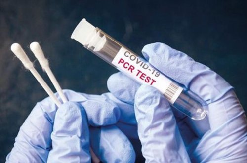 Türkiyədə PCR testi ilə bağlı qayda dəyişdi
