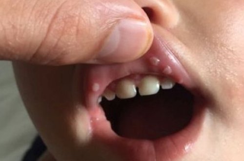 Azərbaycanda daha bir virus sürətlə yayılmağa başladı - 10 gün içində ...