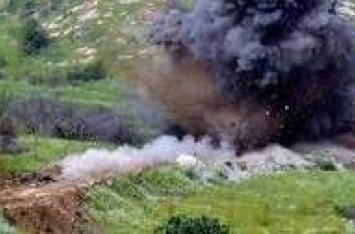 Goranboy sakini minaya düşüb, ayağı amputasiya edilib