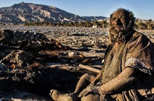 67 ildir çimməyən kişini müayinə edən həkimlər şoka düşdü