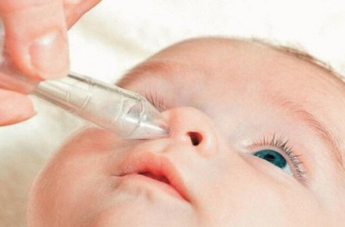 Bakıda 3 yaşlı uşağın burnundan çıxan həkimi ŞOKA SALDI - FOTO