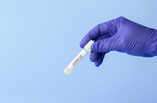 Azərbaycanda koronavirusa sutkalıq yoluxma 3 mini ötüb