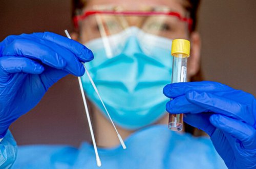 Azərbaycanda son sutkada 2 186 nəfər COVID-19-a yoluxub, 14 nəfər vəfat edib - FOTO