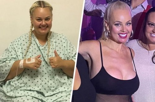 Австралийка похудела на 88 кг, чтобы стать похожей на Барби - ФОТО