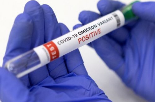 Gürcüstanda “Omikron”a 1 754 nəfər yoluxub, onların 3-ü ölüb