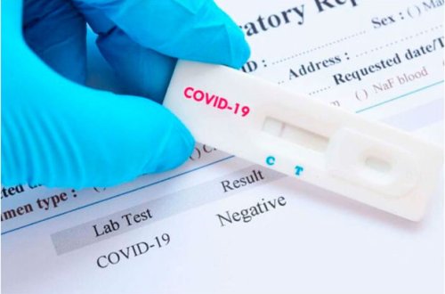 İnfeksionist: “PCR testi mənfi çıxanlar da koronaviruslu ola bilər”