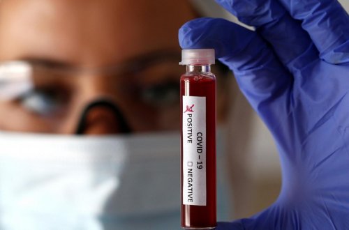 COVID-19-a yoluxma rəqəmlərinin artmasının əsas səbəbi məlum olub