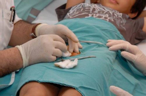 Azərbaycanda sünnət DƏHŞƏTİ: Həkim uşağın cinsiyyət orqanını kəsdi (VİDEO)