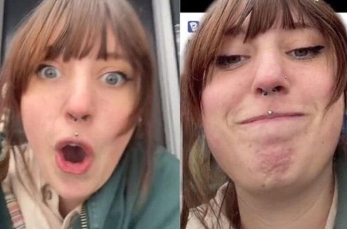 Qadının daxilində dişləri və saçları olan şiş tapıldı - VİDEO