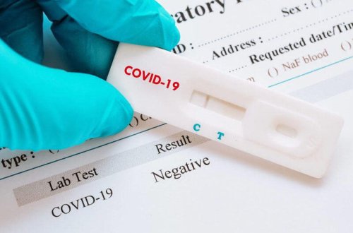 Apteklərdə satılan koronavirus testləri nə dərəcədə etibarlıdır? - TƏBİB açıqladı