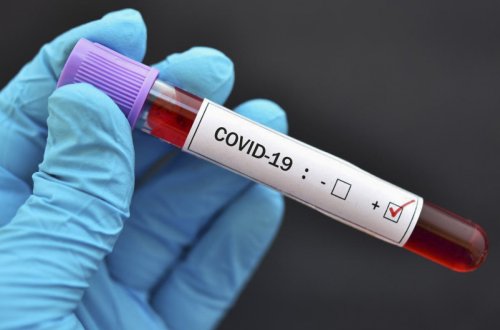 İranda son sutkada 116 nəfər COVID-19-dan ölüb