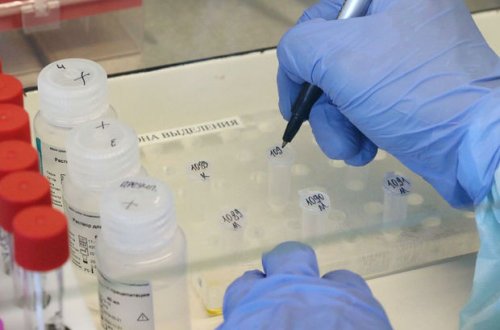 Создана тест-система, определяющая COVID-19 на ранней стадии