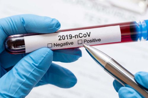 Названа особенность антител к штамму 