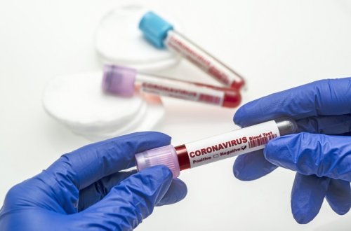 Azərbaycanda daha 1 755 nəfər koronavirusa yoluxub, 23 nəfər ölüb