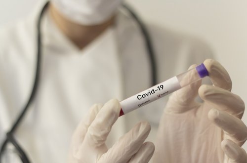 Azərbaycanda daha 369 nəfər koronavirusa yoluxub, 17 nəfər ölüb