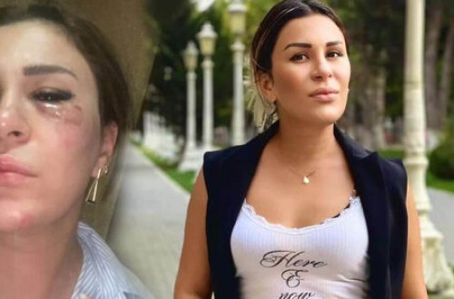 Ülviyyə Rusiyada qəzaya düşdü - VİDEO