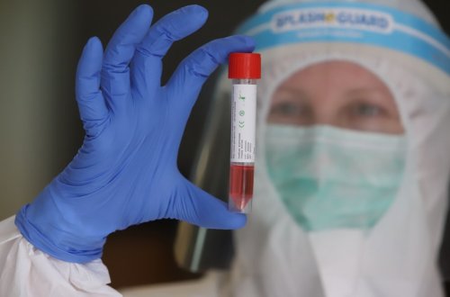 Azərbaycanda son sutkada 47 nəfər COVID-19-a yoluxub, iki nəfər vəfat edib - FOTO