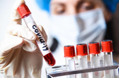 Azərbaycanda daha 40 nəfər koronavirusa yoluxub, 3 nəfər ölüb