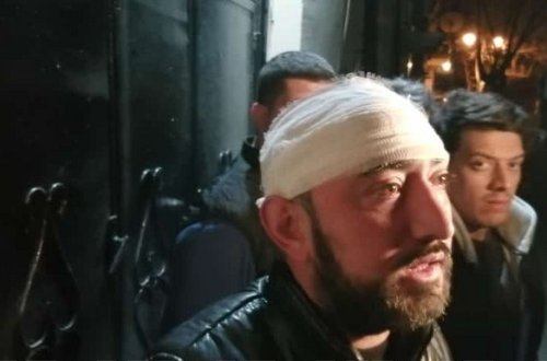 Bakıda gecə klubunda partlayış zamanı yaralananların bir qisminin adları məlum olub