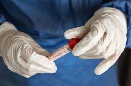 ABŞ-da koronavirusun mənşəyi ilə bağlı yeni araşdırma aparılıb