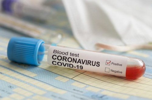 Azərbaycanda son sutkada 38 nəfər COVID-19-a yoluxub, bir nəfər vəfat edib - FOTO