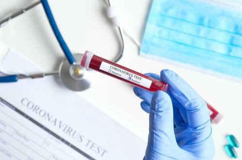 Azərbaycanda son sutkada 25 nəfər COVID-19-a yoluxub, iki nəfər vəfat edib - FOTO