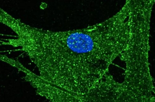 İngiltərədə dəri hüceyrəsi 30 il cavanlaşdı