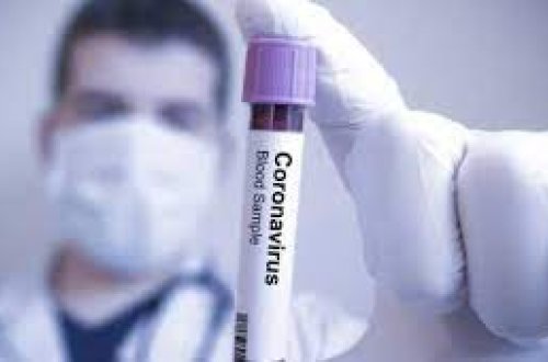 Gürcüstanda daha 392 nəfər koronavirusa yoluxub