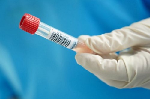 İtaliyada koronavirusun yeni variantı aşkarlanıb