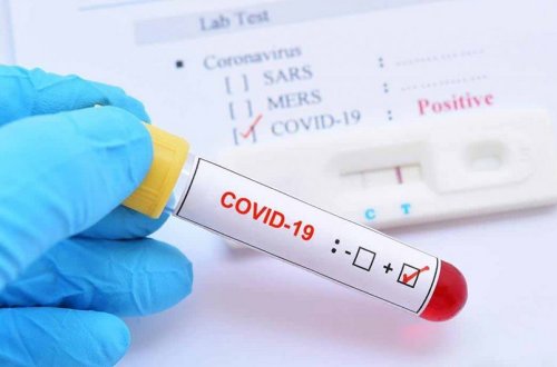 В Азербайджане за сутки коронавирусом заразились три человека